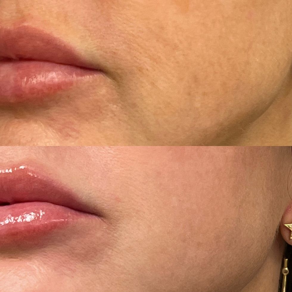 close up of a person's lips