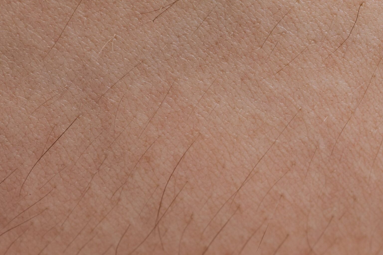 Close-up of bare skin texture illustrating concerns about injectable tanning peptides