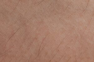 Close-up of bare skin texture illustrating concerns about injectable tanning peptides