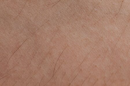 Melanotan II Is Selling a Tan. Dermatologists Call It Dangerous. Close-up of bare skin texture illustrating concerns about injectable tanning peptides