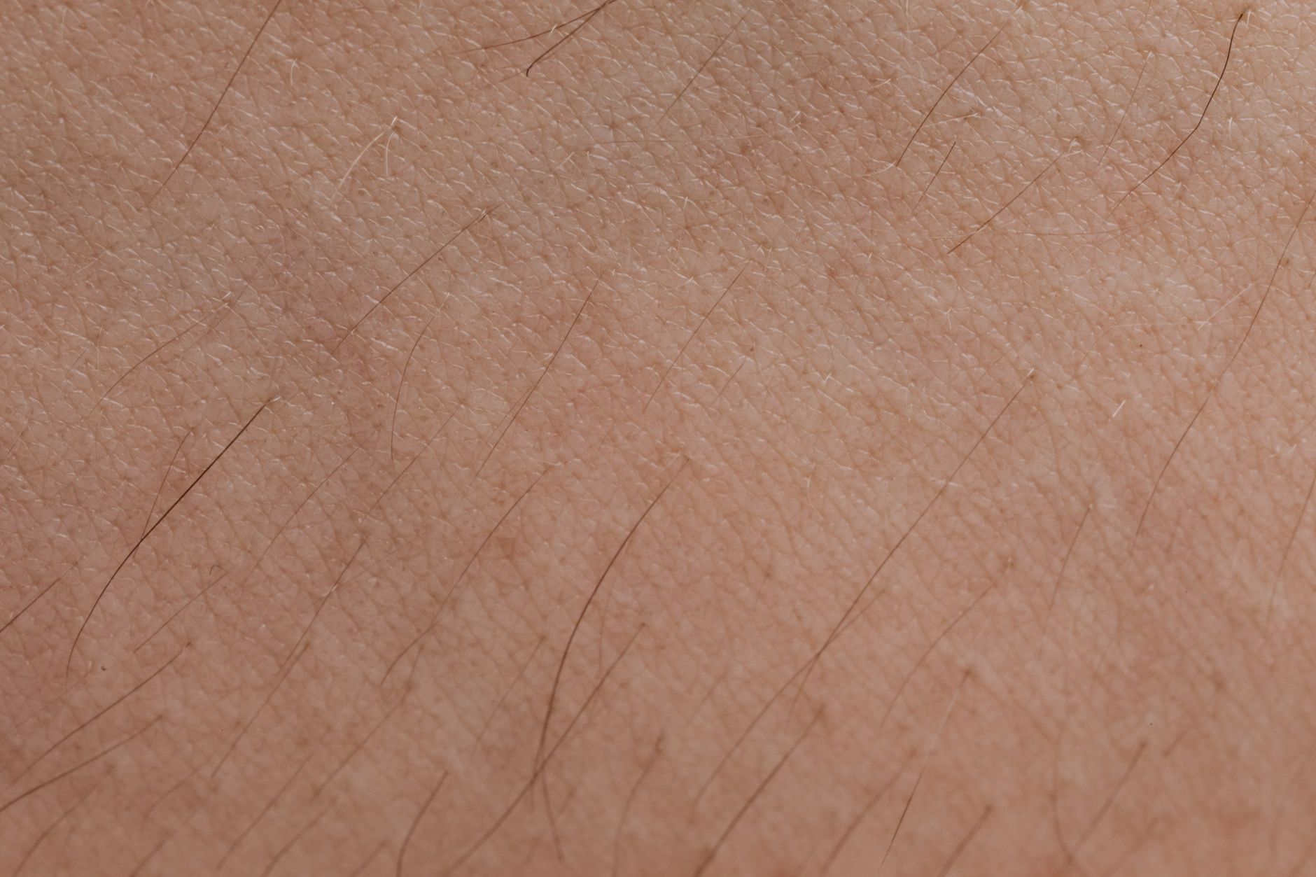 Close-up of bare skin texture illustrating concerns about injectable tanning peptides
