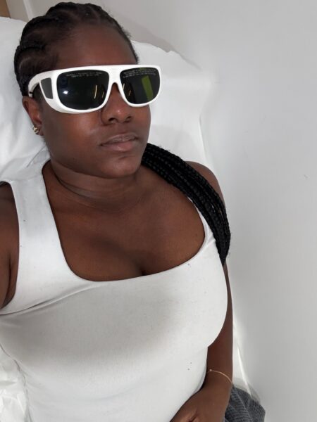 A Burn Scar and a Decade Later, Laser Hair Removal Finally Worked A person preparing for a laser skin treatment in a clinical setting