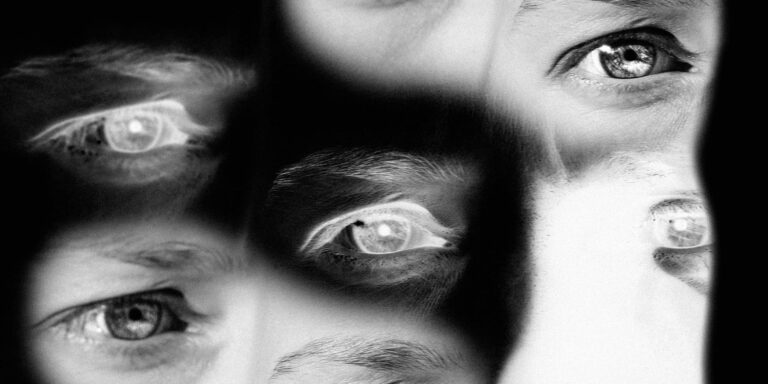 Under-Eye Surgery Moves From Taboo to Treatment Room Close-up of a woman's eye area with visible under-eye skin texture